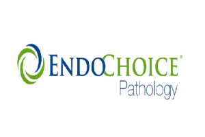 Endochoice